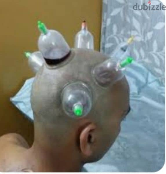 hijama karwane ke liye contact kre 10sr/cup 1