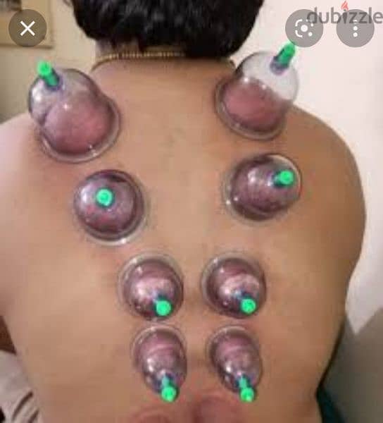 hijama karwane ke liye contact kre riyad 10sr/cup 5