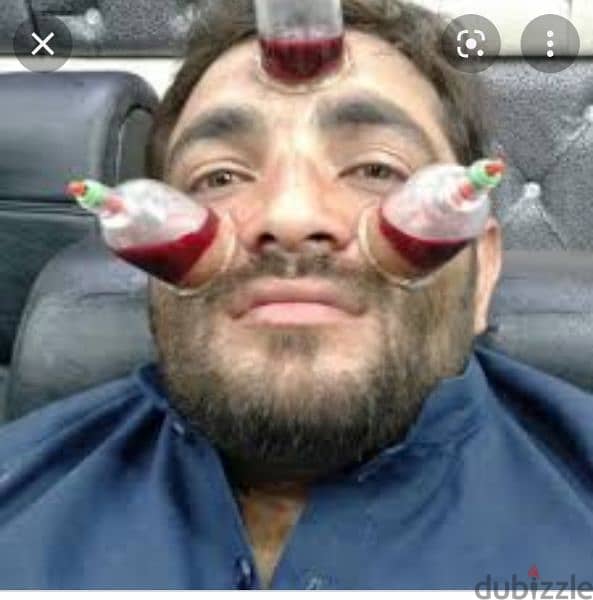 hijama karwane ke liye contact kre 10sr/cup 1