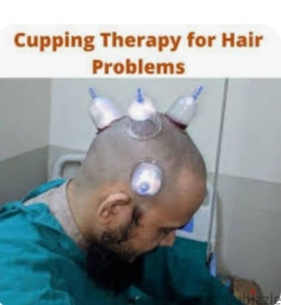 hijama karwane ke liye contact kre 10sr/cup 3