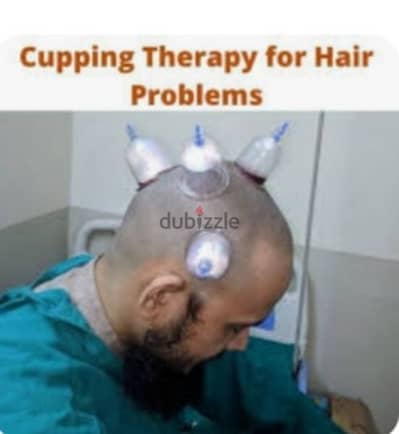 hijama