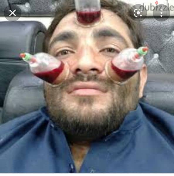 hijama karwane ke liye contact kre 10sr/cup 3