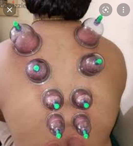 hijama karwane ke liye contact kre10sr/cup 4