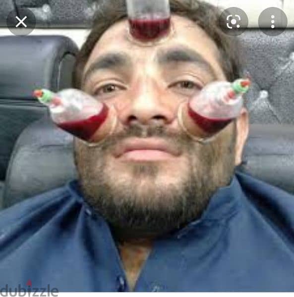 hijama karwane ke liye contact kre 10sr/cup 2